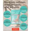 DERMAL KOREA Foot Peeling Mask 2 Pack For Dry Foot And Cracked Heel & Callus With Aloe Vera And Collagen – Exfoliating Peel Mask With Aha, Bha, & Pha And For Moisturizing, Soothing & Refreshing Feet(3 Count (Pack of 1))
